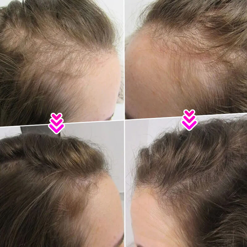 EELHOE HAIR™ Puder przeciw wypadaniu włosów i szybkie wypełnienie linii włosów