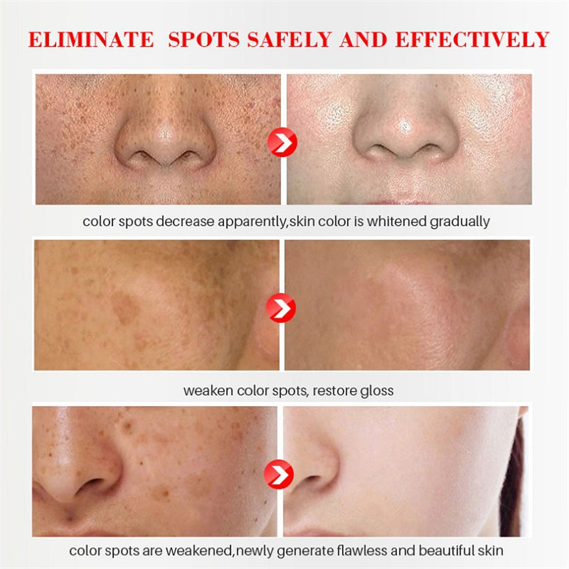 NicoGlow™ Rozjaśniające serum do skóry