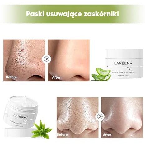 LANBENA™ Złuszczająca maska do usuwania zaskórników z 60 paskami