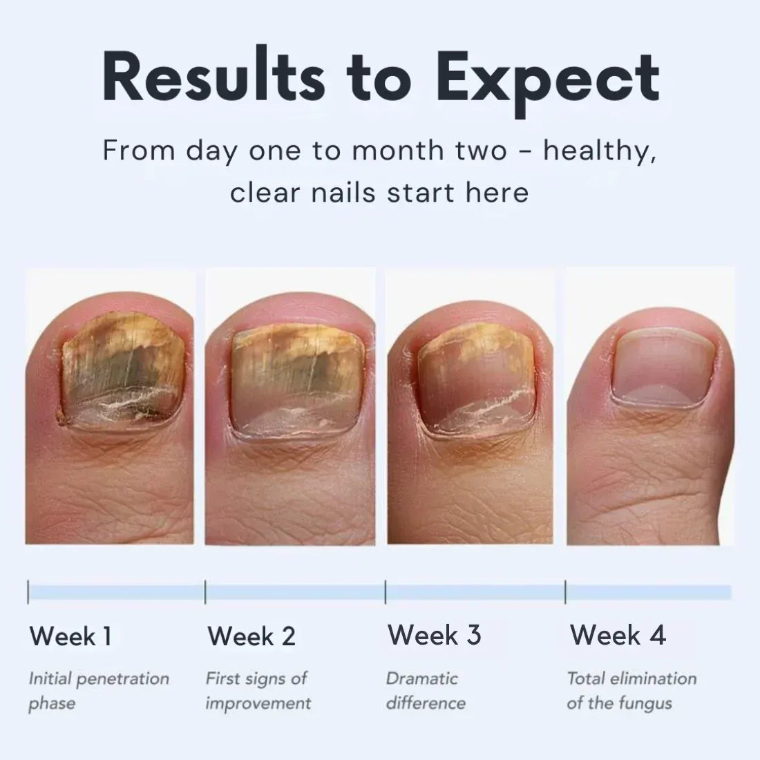 NailClear Pro+™ preparat na problemy z paznokciami z aplikatorem pędzelkowym